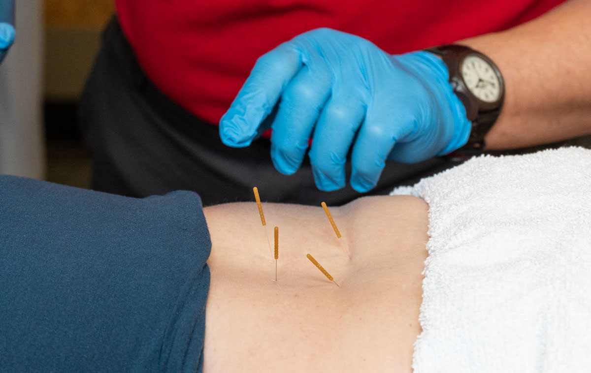 Tommy dry needling